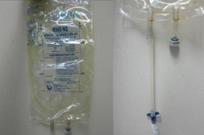 Figure 1: A 3 l saline irrigation bag with stopper is placed in one tube. A piece of suction tubing connects the other end to a 3-way stopper